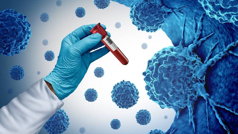 Novi test može otkriti rak i do 3 godine prije pojave simptoma