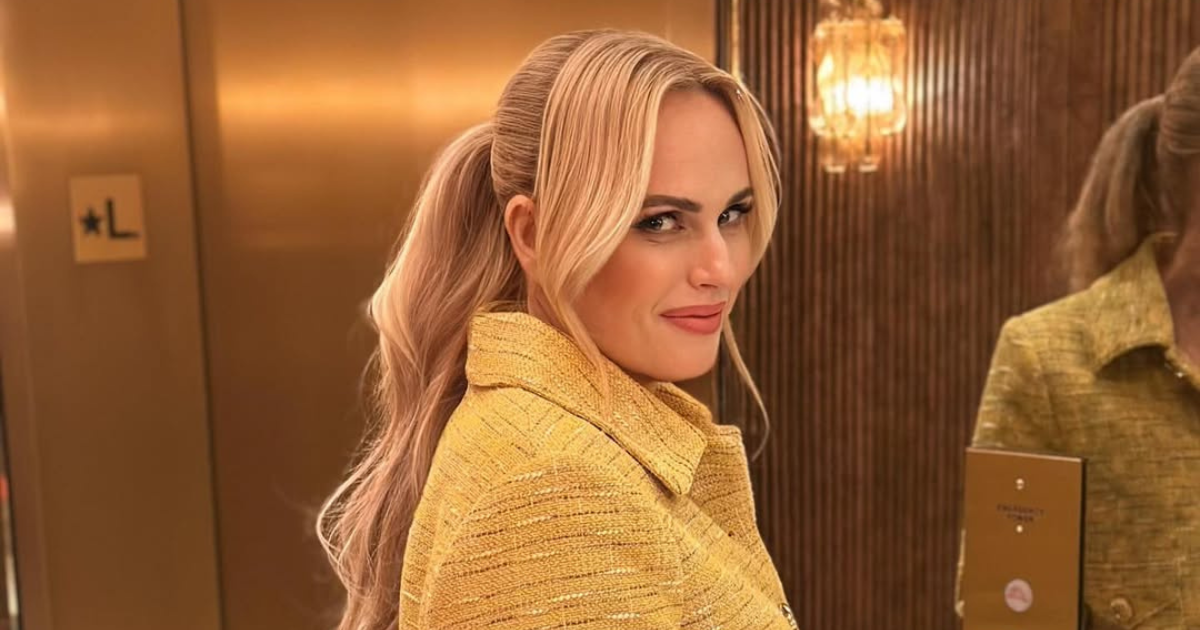 Rebel Wilson završila s razrezanim nosom na setu: “Bila sam prestravljena”