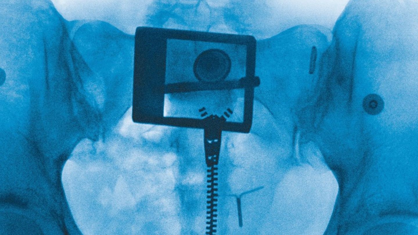 “Virgin” Lorde: Ovaj je album poput slike x -ray