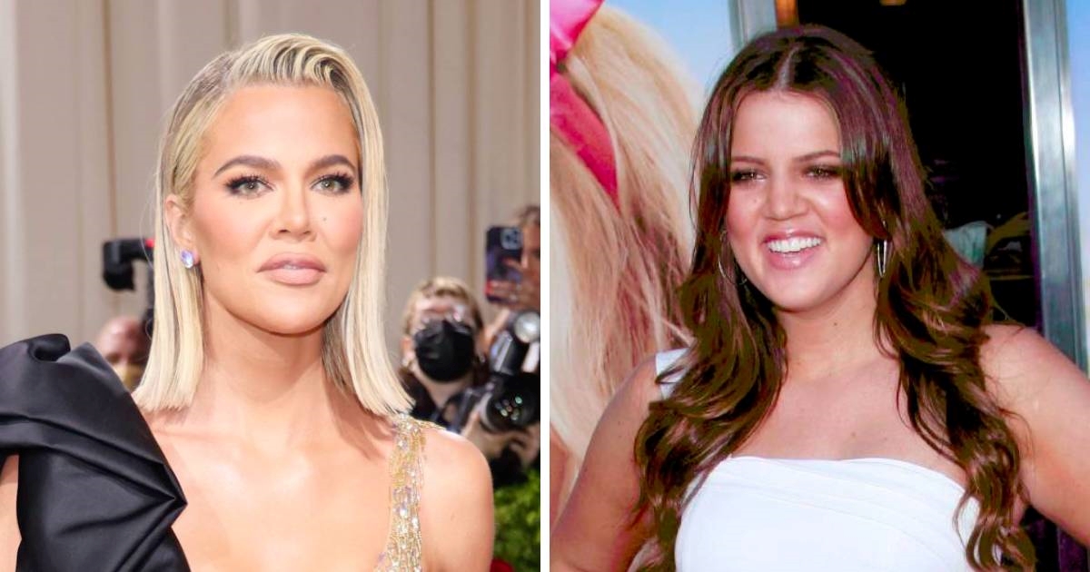 Khloé Kardashian otkrila koje korekcije je radila na sebi: “Nemam što skrivati”