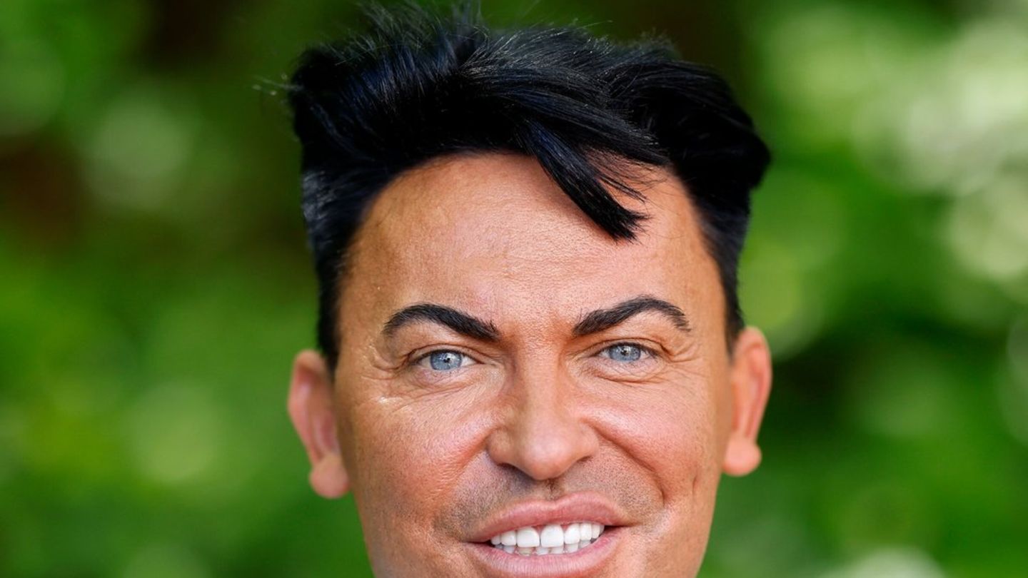 Matthias Mangiapane: Reality Star je izgubio 25 kilograma
