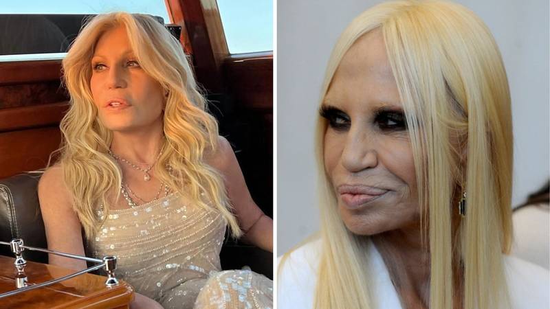 Operacije joj uništile lice, sad je šokirala izgledom: Evo kako se Donatella Versace mijenjala…